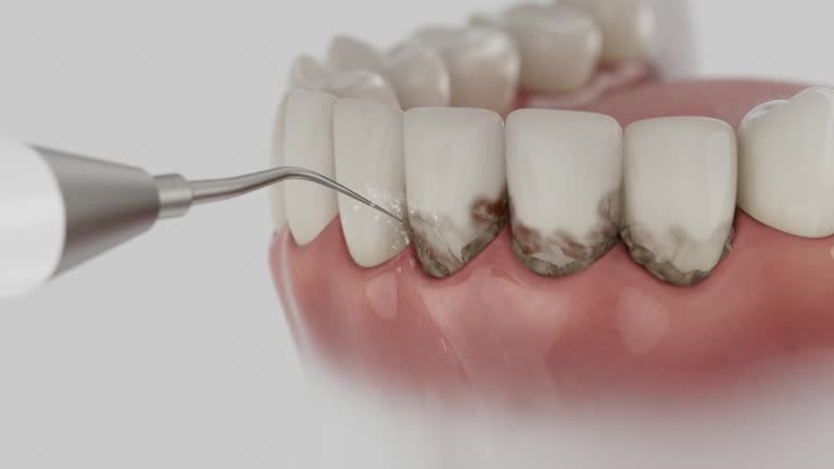 Reliable Dental Implants contractor in Barron, WI by Smile Center Dentistry